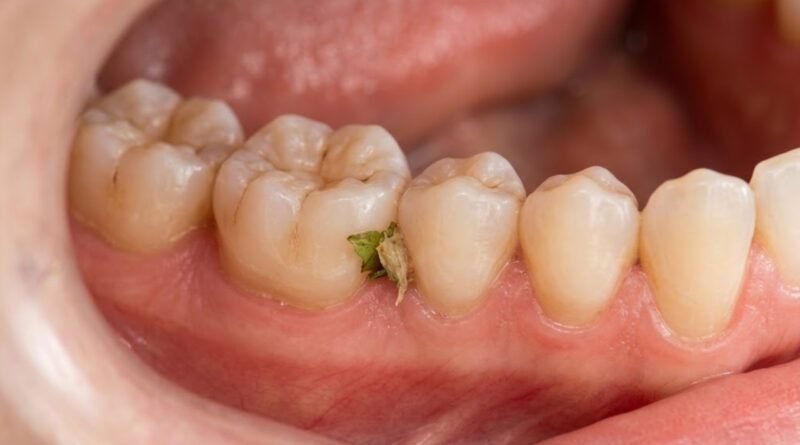 how-to-remove-food-from-teeth